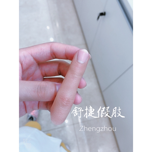 安裝假手指的接口如何處理比較好？