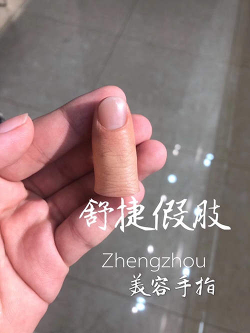 安裝假手指的醫院和費用？