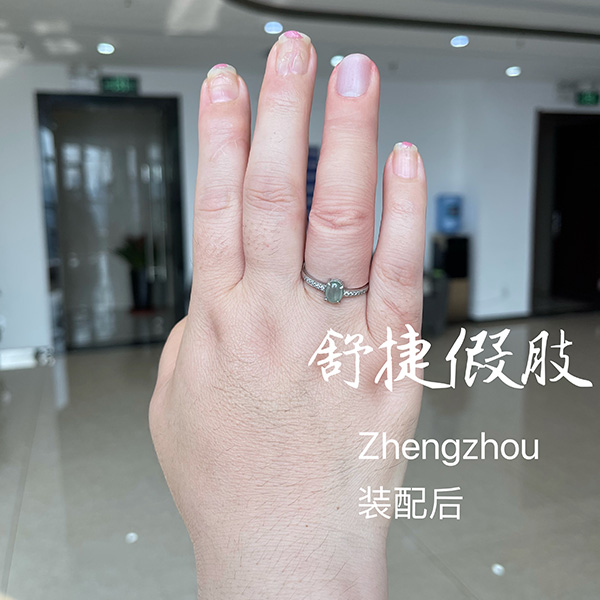 美容假手指裝配后效果，根本看不出來